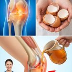 My Mom Could NOT Walk Due to Knee and Bone Pain Until She Tried These!