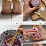 5 Natural Remedies That May Help Heal Cracked Heels