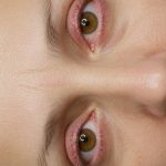 Natural Juice to Boost Vision in Weeks