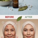Bay Leaves for Wrinkles: A Natural Anti-Aging Remedy That Nourishes the Skin